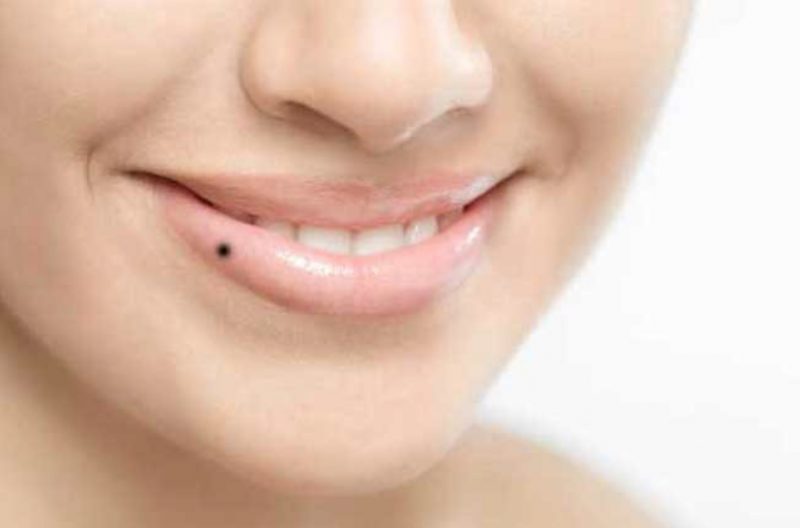 မွဲ႔ေတြကေျပာတဲ့ သင့္အေၾကာင္း MyHealth Myanmar