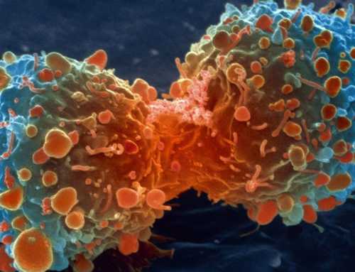 ပျောက်ကင်းဖို့ခက်ခဲနေတဲ့ ကင်ဆာရောဂါကို ကာကွယ်နိုင်ဖို့ အခုကစပြီး ပြင်ဆင်သင့်တဲ့အရာများ